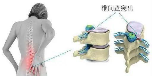 1585718144057022862.jpg 2.jpg